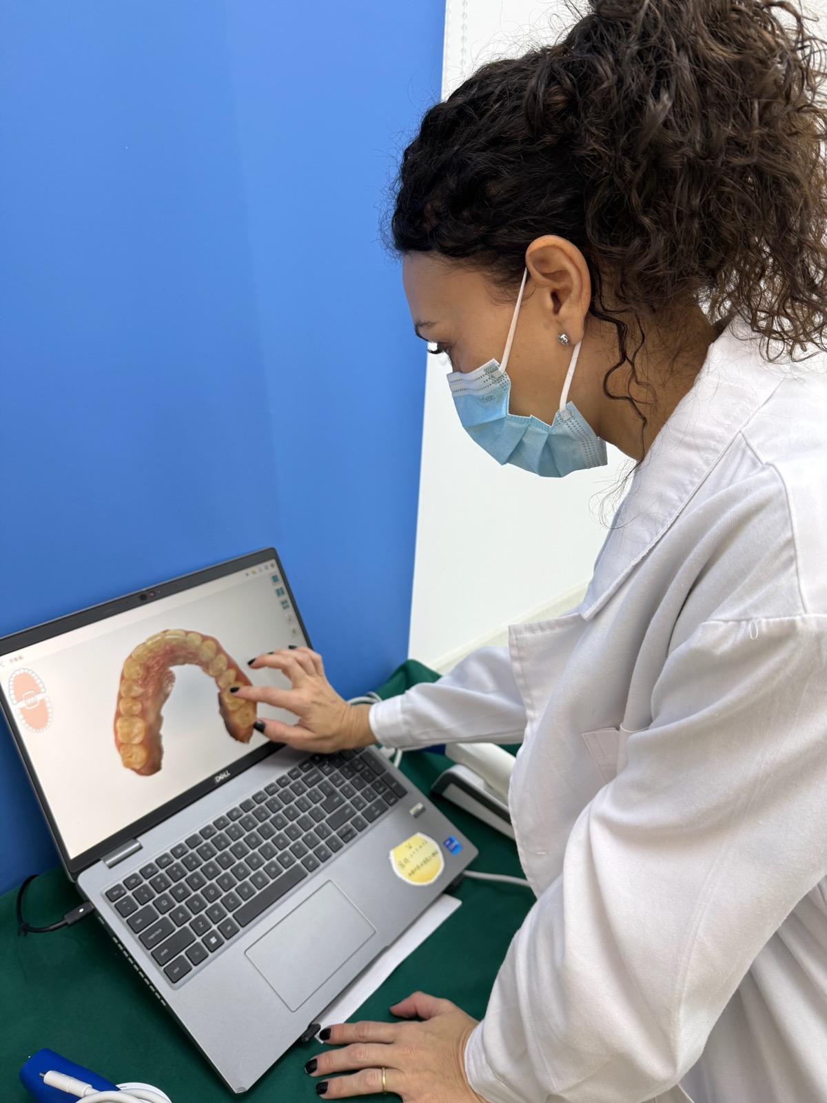 Escáner intraoral durante el tratamiento